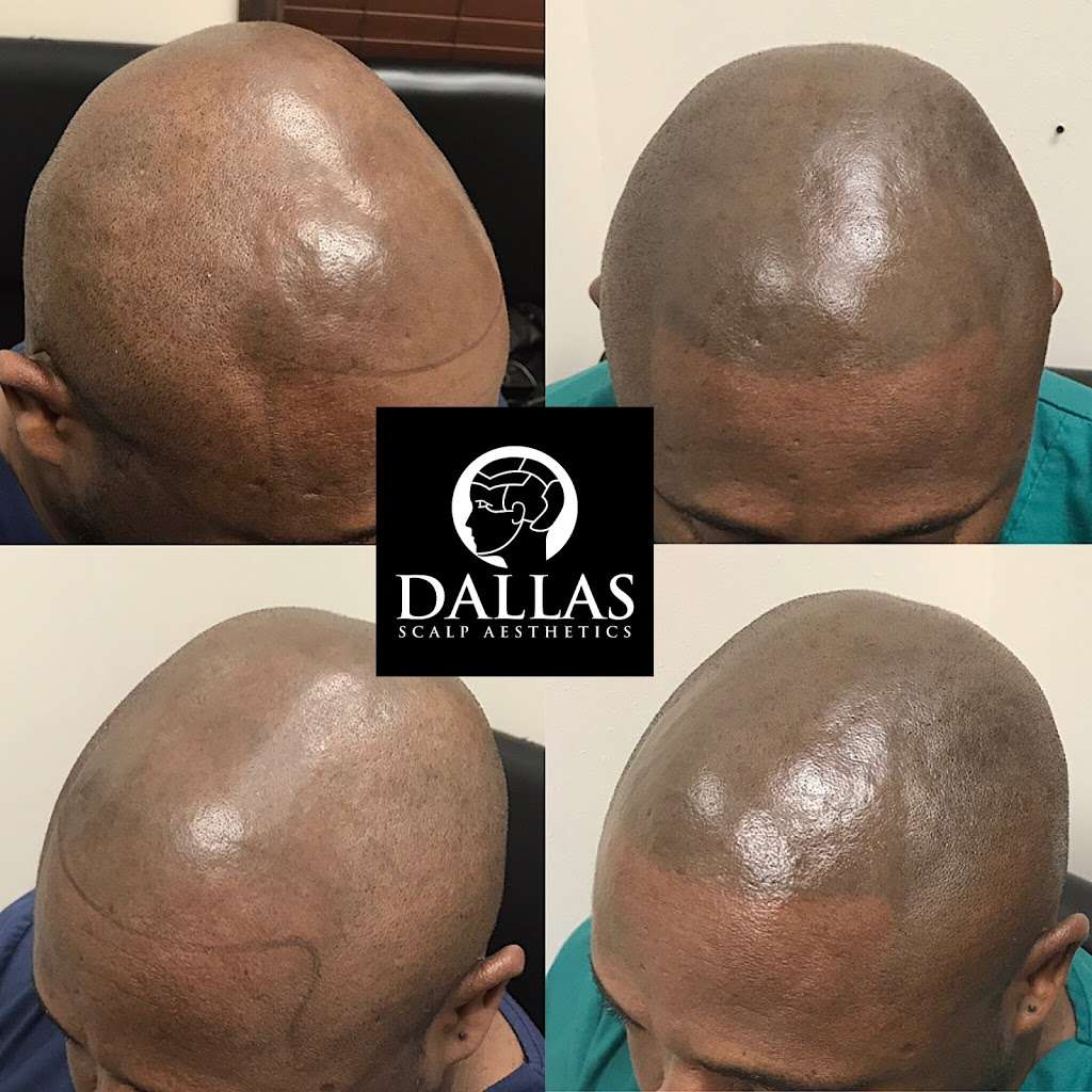 Dallas Scalp Associates | 304 S Cottonwood Dr Ste E, Richardson, TX 75080 | Phone: (214) 242-6912