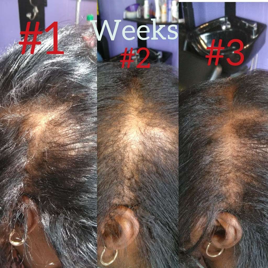 The Strand Collection Natural Hair Growth Solutions | 3813 Liberty Rd, Houston, TX 77026, USA | Phone: (832) 546-2879