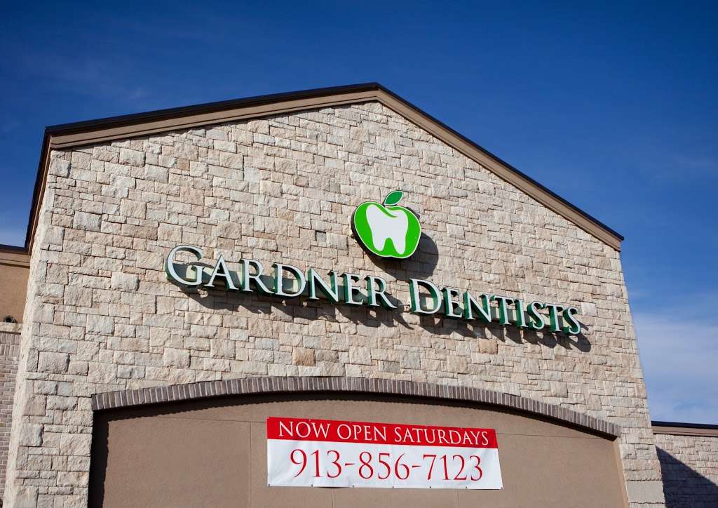 Gardner Dentists LLC | 971 E Lincoln Ln, Gardner, KS 66030, USA | Phone: (913) 856-7123
