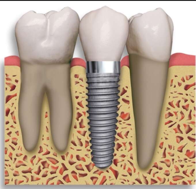 Beauty Smiles Dental Wael H. Obeid, DDS | 13711 Van Nuys Blvd #3, Pacoima, CA 91331, USA | Phone: (818) 890-2600