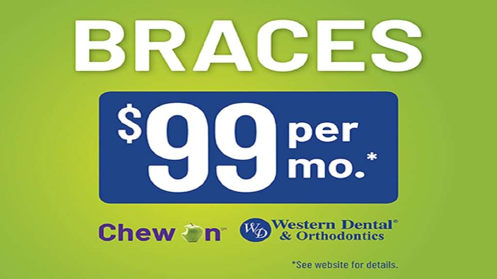 Western Dental & Orthodontics | 791 E Monte Vista Ave, Vacaville, CA 95688, USA | Phone: (707) 301-4096