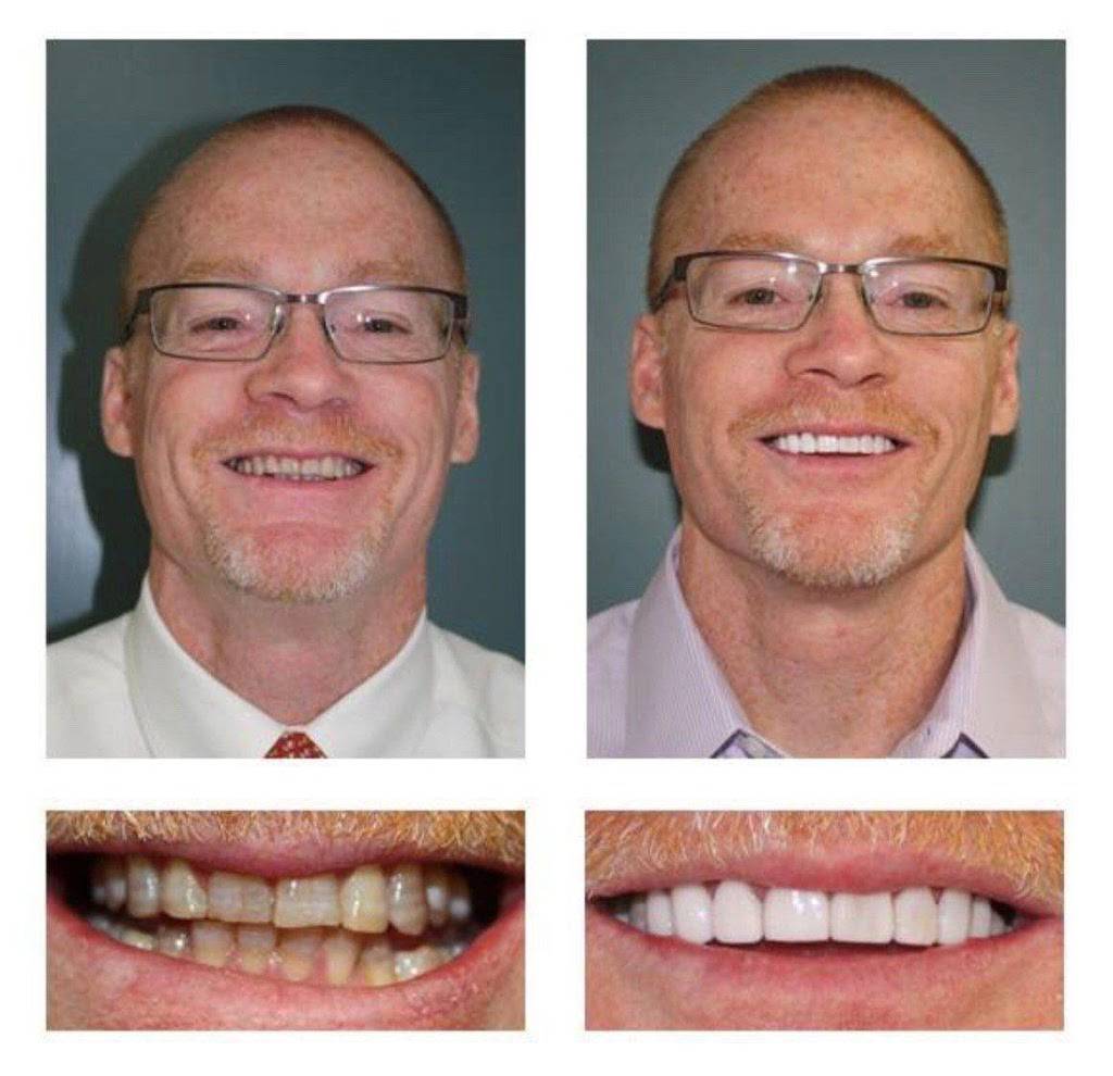 Antoine E Wakim, DDS | 710 N Woodchuck St, Wichita, KS 67212, USA | Phone: (316) 243-9795