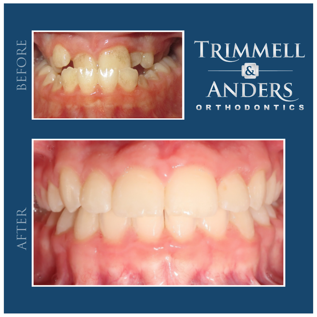 Trimmell & Anders Orthodontics | 3933 N Maize Rd #300, Maize, KS 67101, USA | Phone: (316) 260-6566