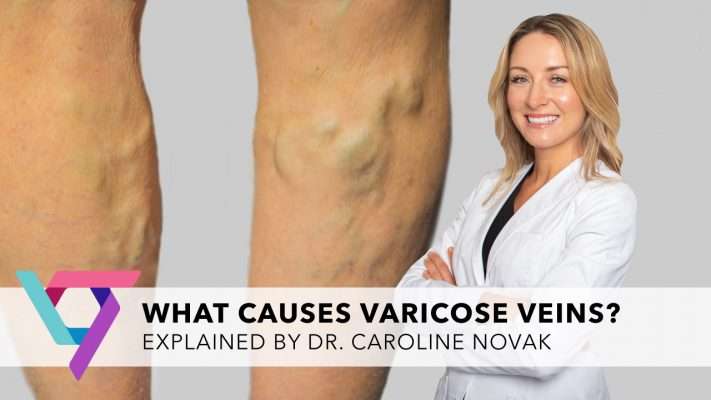 Spider and Varicose Vein Treatment Center | 3525, 2 Sears Dr suite 101, Paramus, NJ 07652, USA | Phone: (201) 632-5355