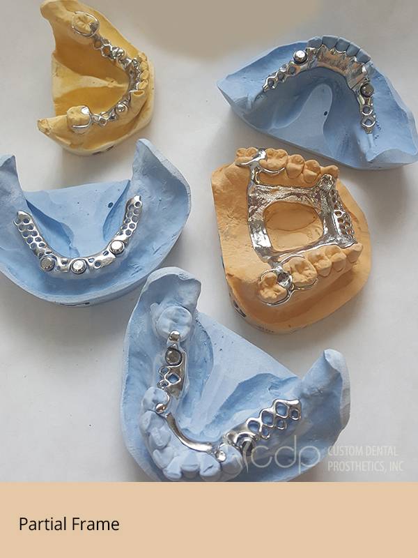 Custom Dental Prosthetics | 19155 SE McLoughlin Blvd #105, Gladstone, OR 97027, USA | Phone: (800) 595-3495