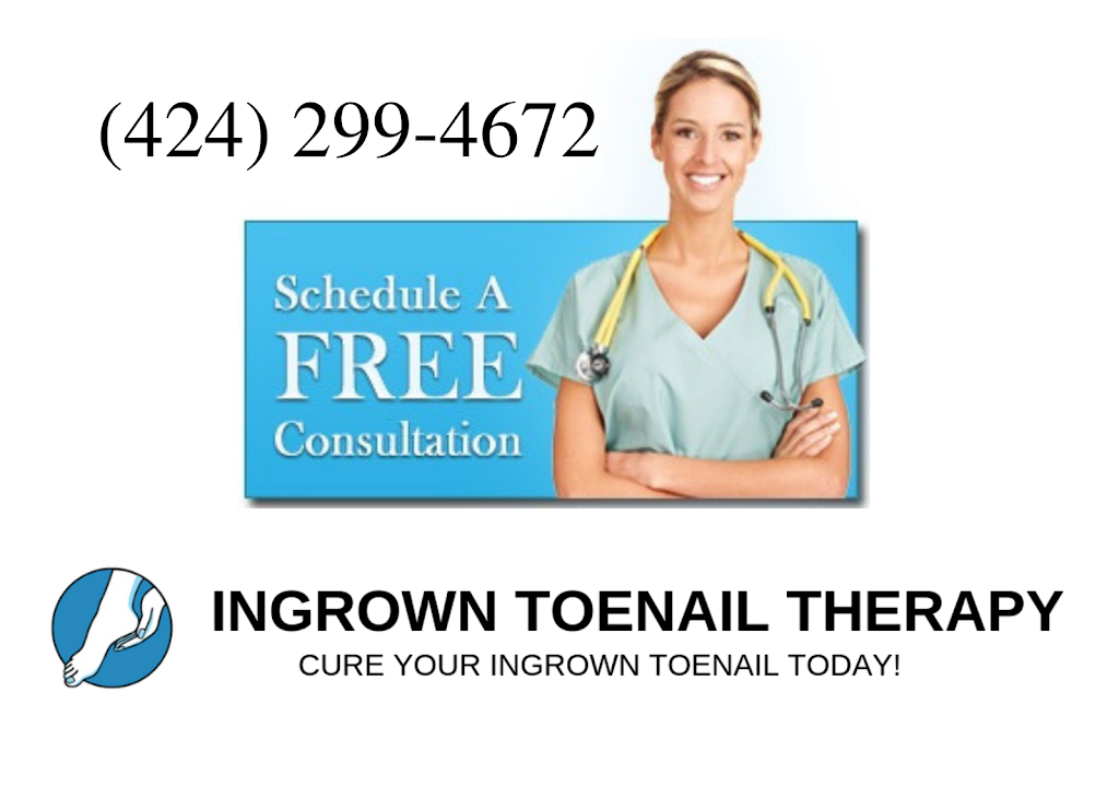 Ingrown Toenail Treatment in Toenail Fungus Treatment Center | 844 W Glenoaks Blvd, Glendale, CA 91202, USA | Phone: (424) 299-4627