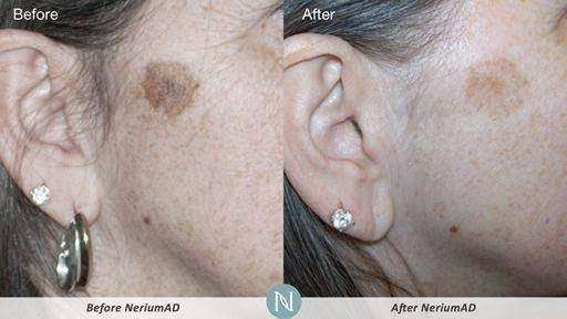 Amazing Skin | 13 Oakland Rd, Pepperell, MA 01463, USA | Phone: (978) 877-0972