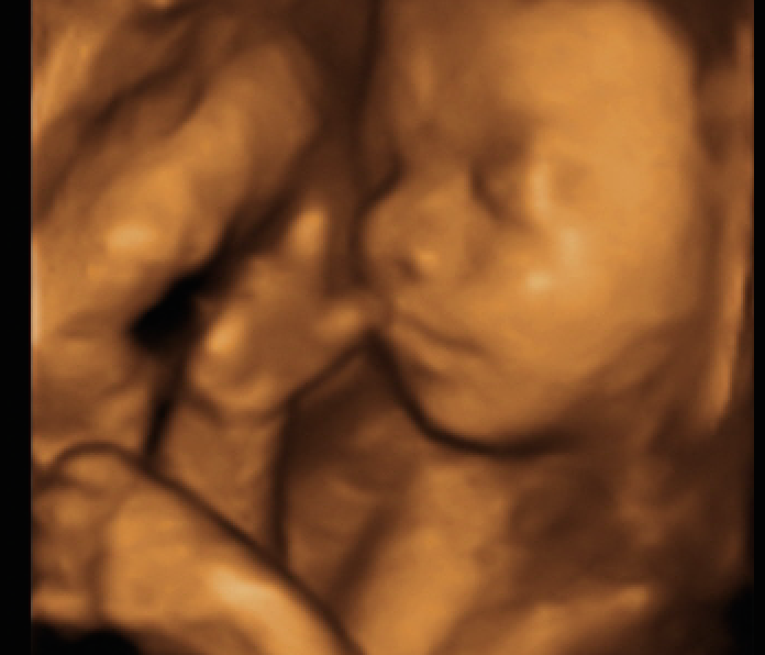 My Sweet Baby 3D/4D Ultrasounds | 5530 25th St, Columbus, IN 47203 | Phone: (812) 260-1881