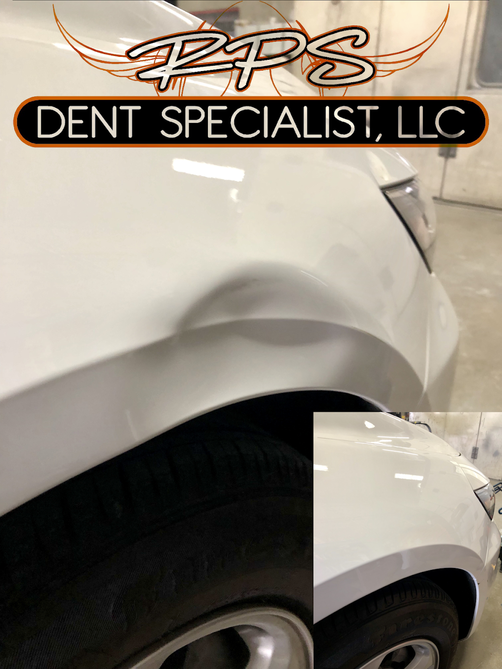 RPS Dent Specialists | 7900 Eastern Ave, Baltimore, MD 21224, USA | Phone: (443) 580-0920