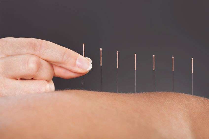 Get Your Qi On Acupuncture | 815 Grand Ave #105, San Marcos, CA 92078, USA | Phone: (760) 891-8083
