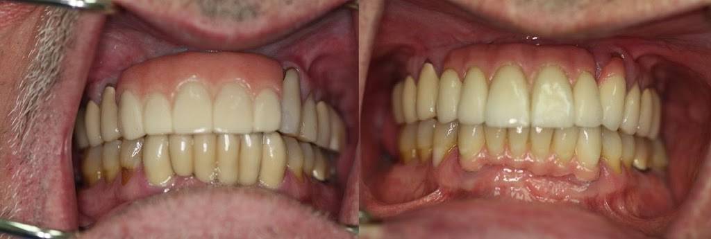 Malo Dental Prosthodontics | 2525 Embassy Dr #1, Hollywood, FL 33026, USA | Phone: (954) 430-3444