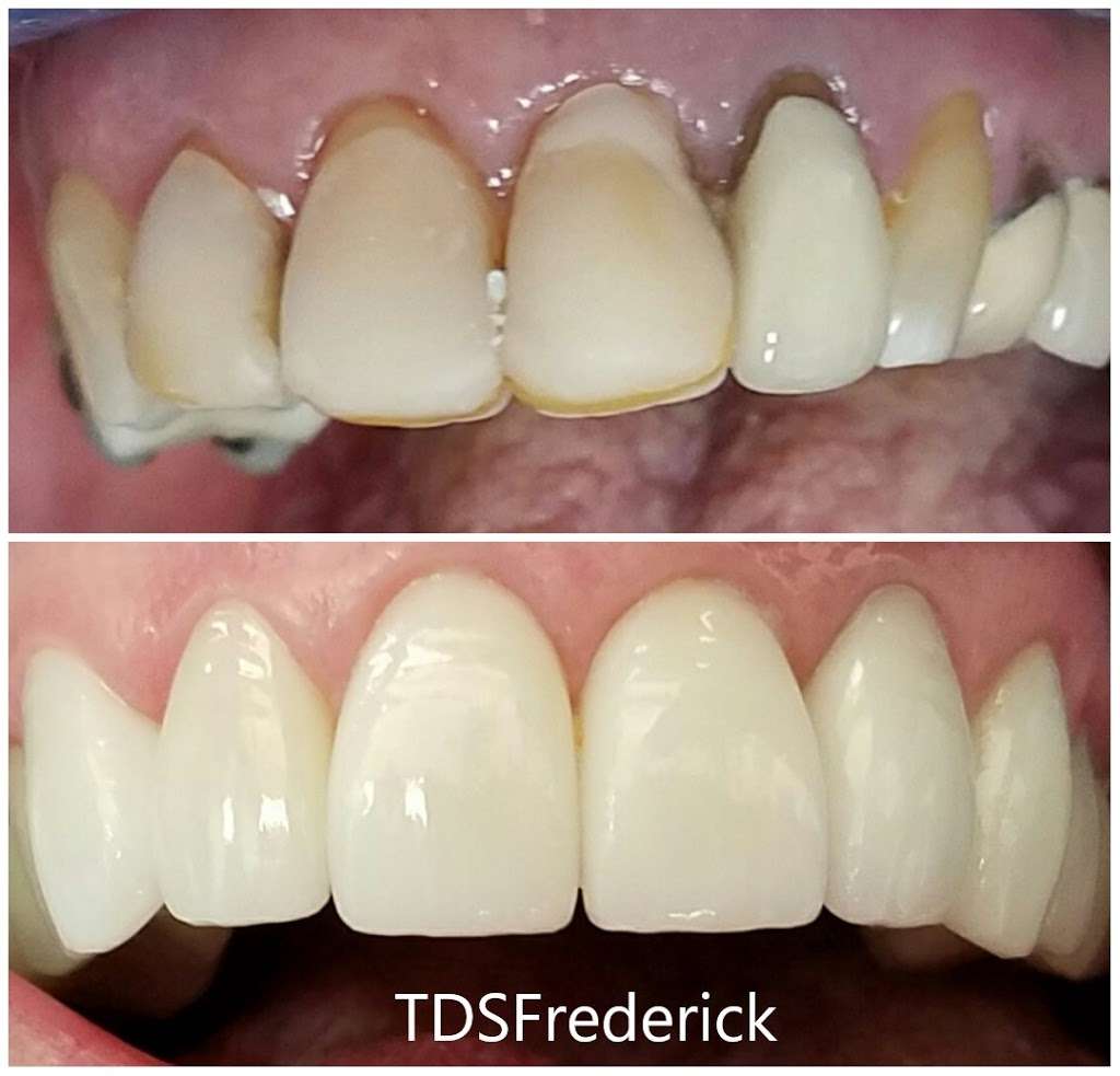 The Dental Studio of Frederick | 2100 Old Farm Dr B, Frederick, MD 21702, USA | Phone: (301) 698-9552