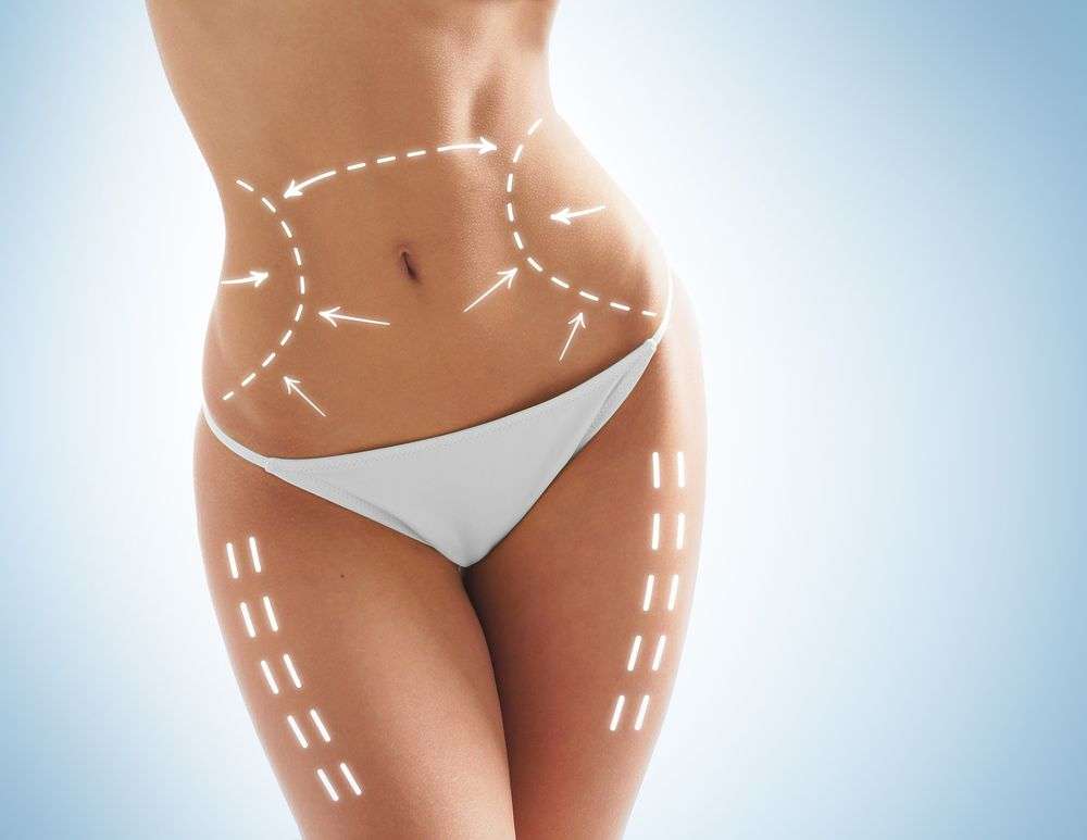 Smart Liposuction Houston | Houstons SmartLipo Experts | 6363 Woodway Dr Suite A-850, Houston, TX 77057 | Phone: (832) 429-2171