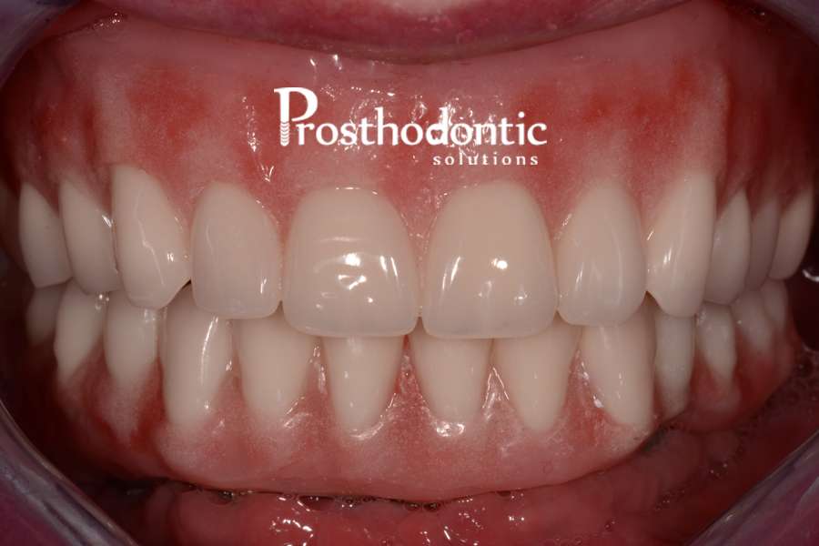 Prosthodontic Solutions-Dr. Michael Waliszewski | 19990 W Greenfield Ave, Brookfield, WI 53045, USA | Phone: (262) 787-0677