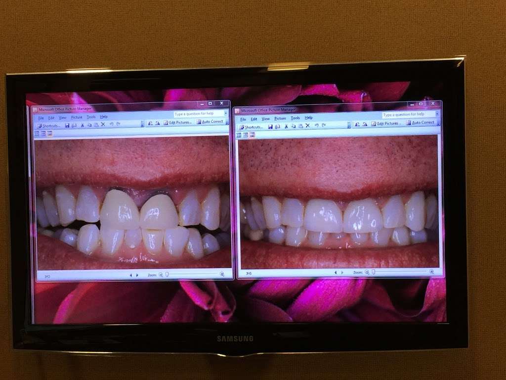 Lakeshore Cosmetic Dentistry | 13551 Will Clayton Pkwy #5, Humble, TX 77346 | Phone: (281) 812-1122