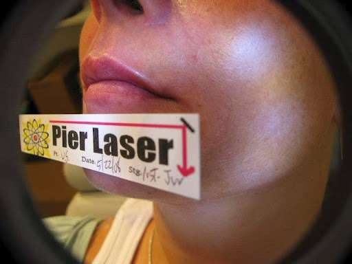 Scott David Reiter, M.D - Pier Laser Medical | 3010 Lincoln Blvd, Santa Monica, CA 90405, USA | Phone: (310) 399-9142