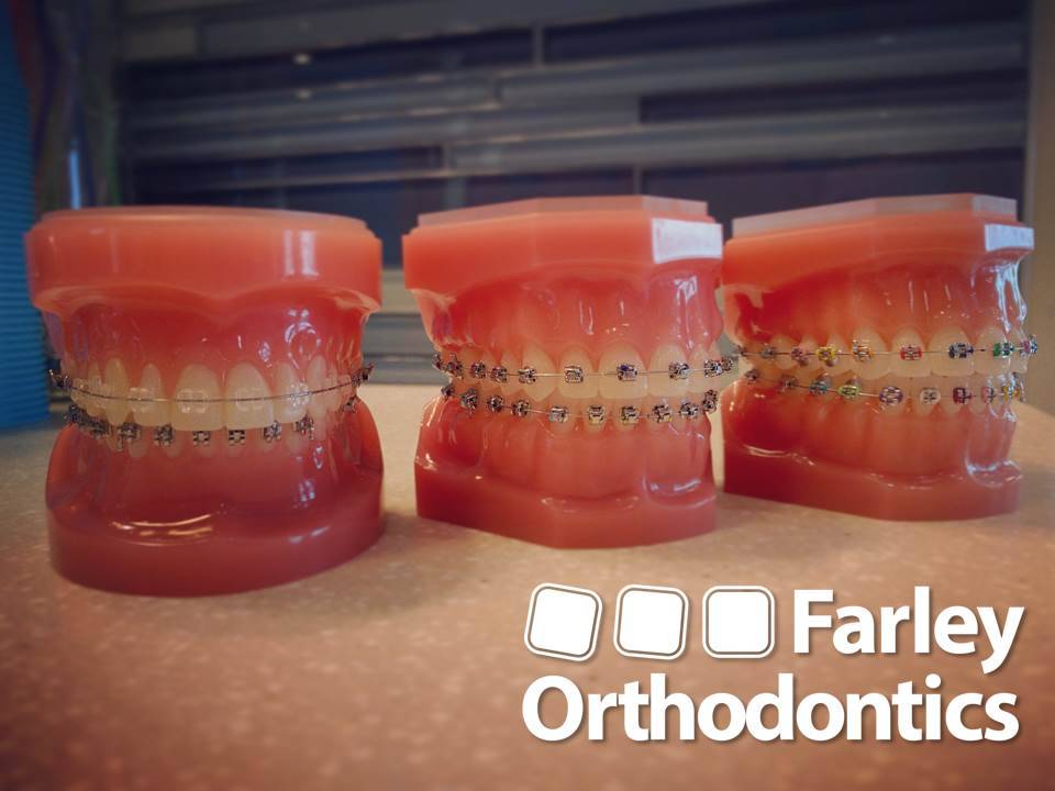Farley Orthodontics | 3265 Niagara Falls Blvd, North Tonawanda, NY 14120 | Phone: (716) 692-9292