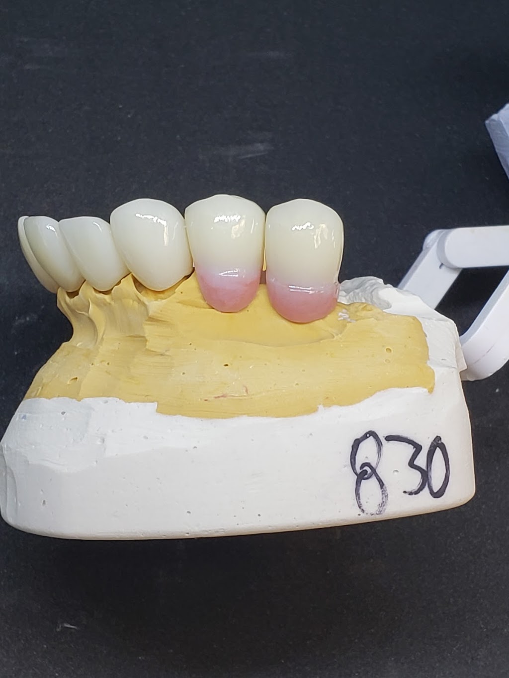 3D Dental Lab Inc | 2427 Baker Dr suite a, Mesquite, TX 75150, USA | Phone: (972) 270-9995