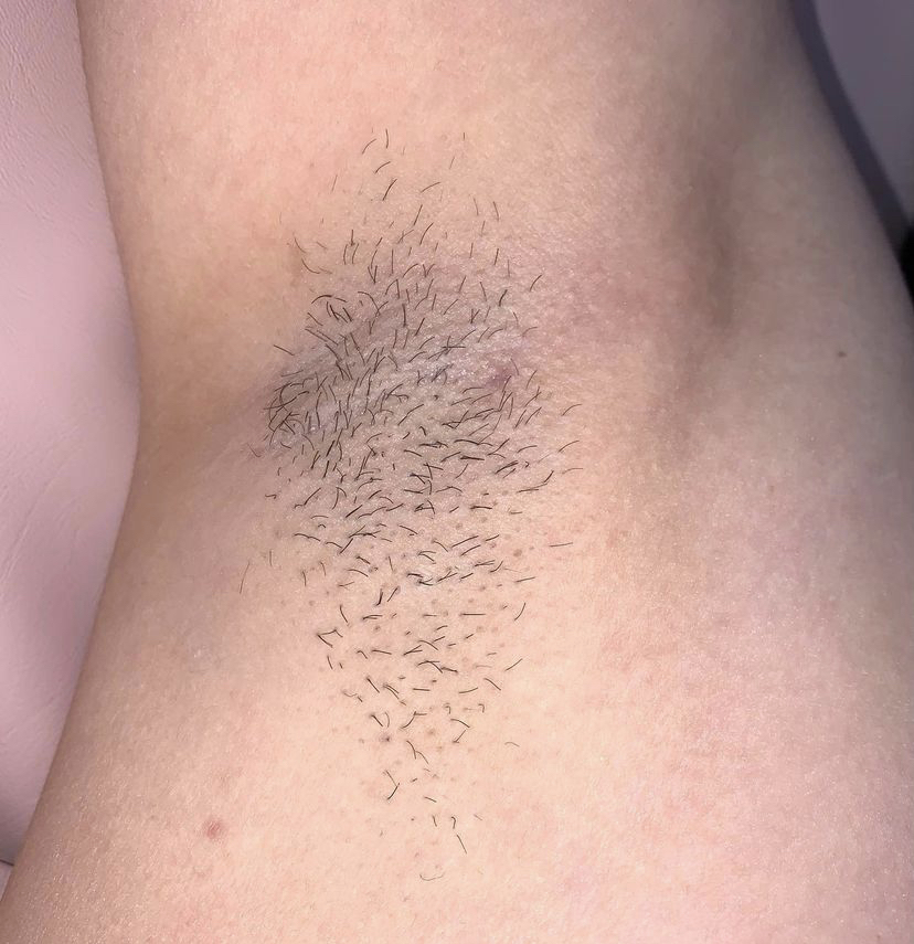 Dream Esthetics | 740 Texas St, Fairfield, CA 94534, USA | Phone: (707) 631-3583