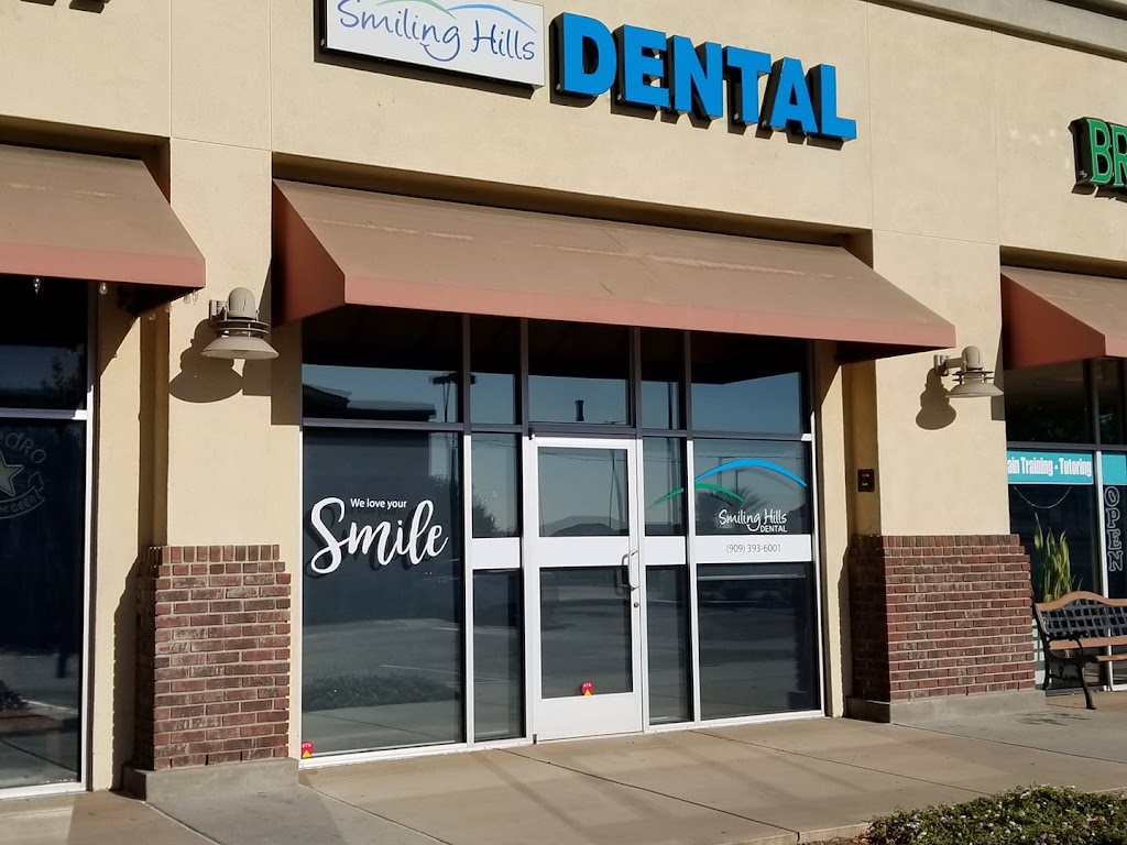 Smiling Hills Dental | 15870 Soquel Canyon Pkwy suite i, Chino Hills, CA 91709 | Phone: (909) 393-6001