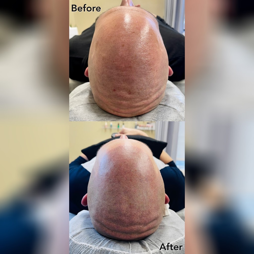 Paramedical Pigments Beauty Co. - Scalp Micropigmentation studio & Day Spa | second floor, 1329 E Kemper Rd Suite 4218 F, Cincinnati, OH 45246 | Phone: (513) 641-8516