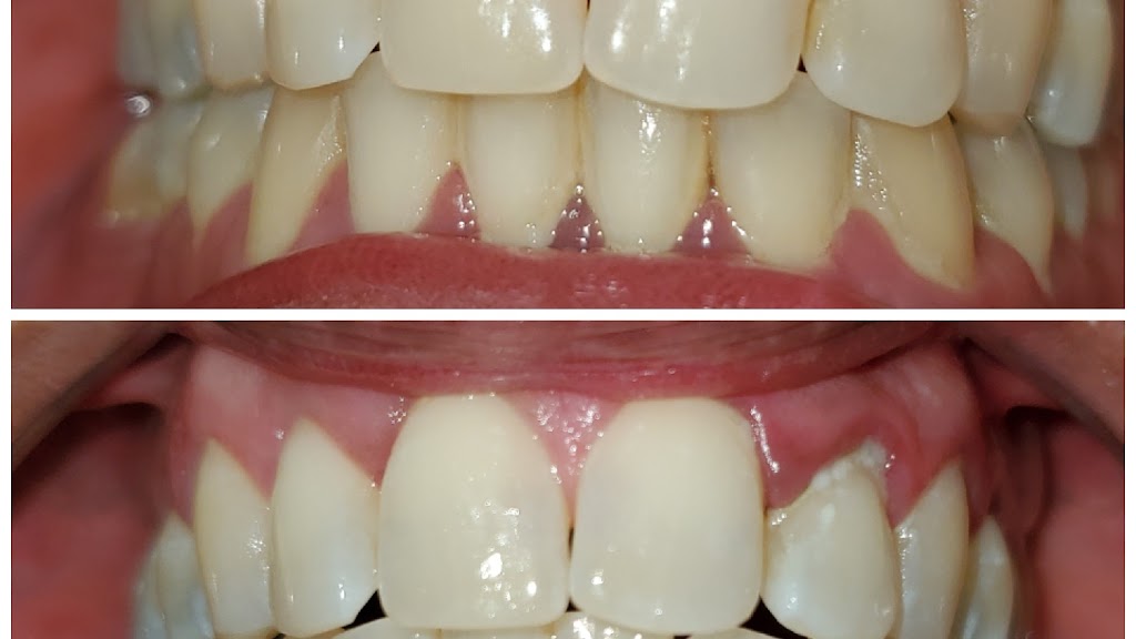 New Smiles Teeth Whitening | 222 Grifford Dr, Kissimmee, FL 34758, USA | Phone: (407) 279-0490