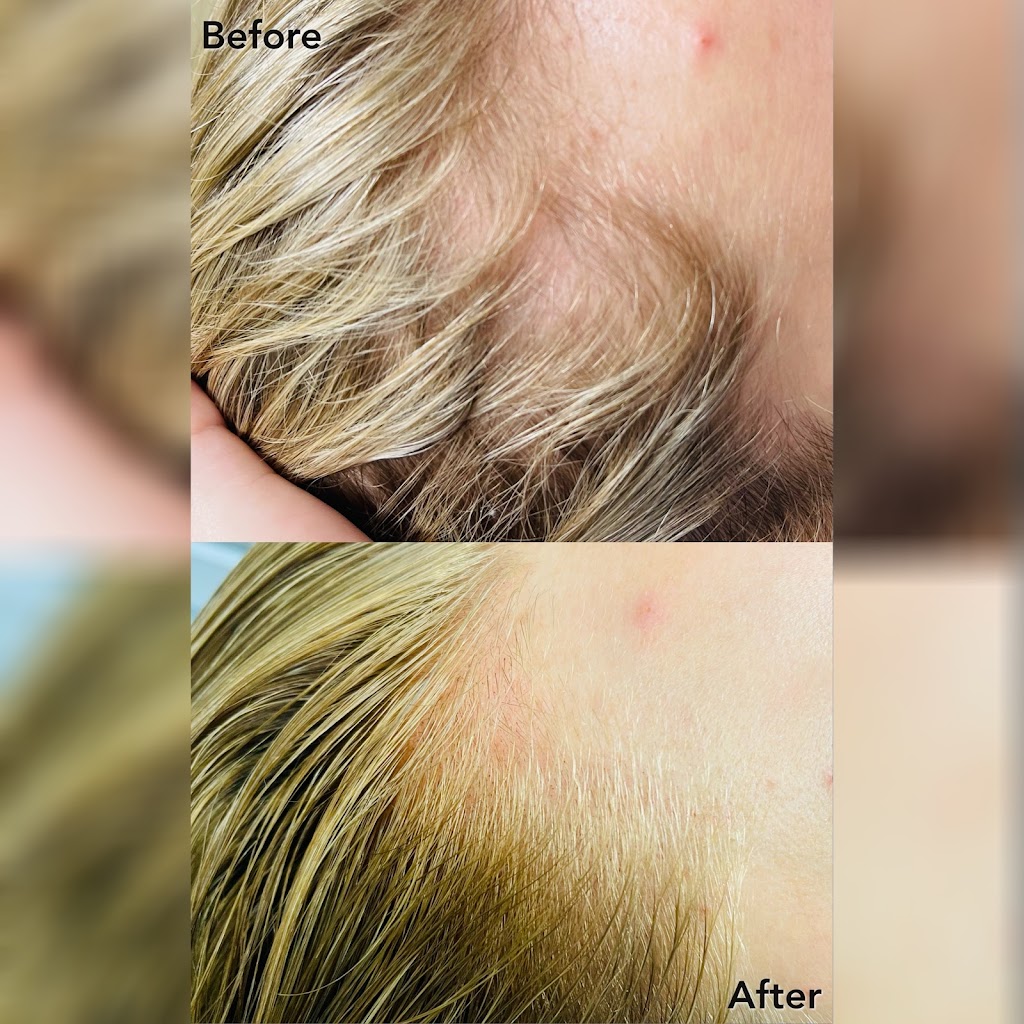 Paramedical Pigments Beauty Co. - Scalp Micropigmentation studio & Day Spa | second floor, 1329 E Kemper Rd Suite 4218 F, Cincinnati, OH 45246, USA | Phone: (513) 641-8516