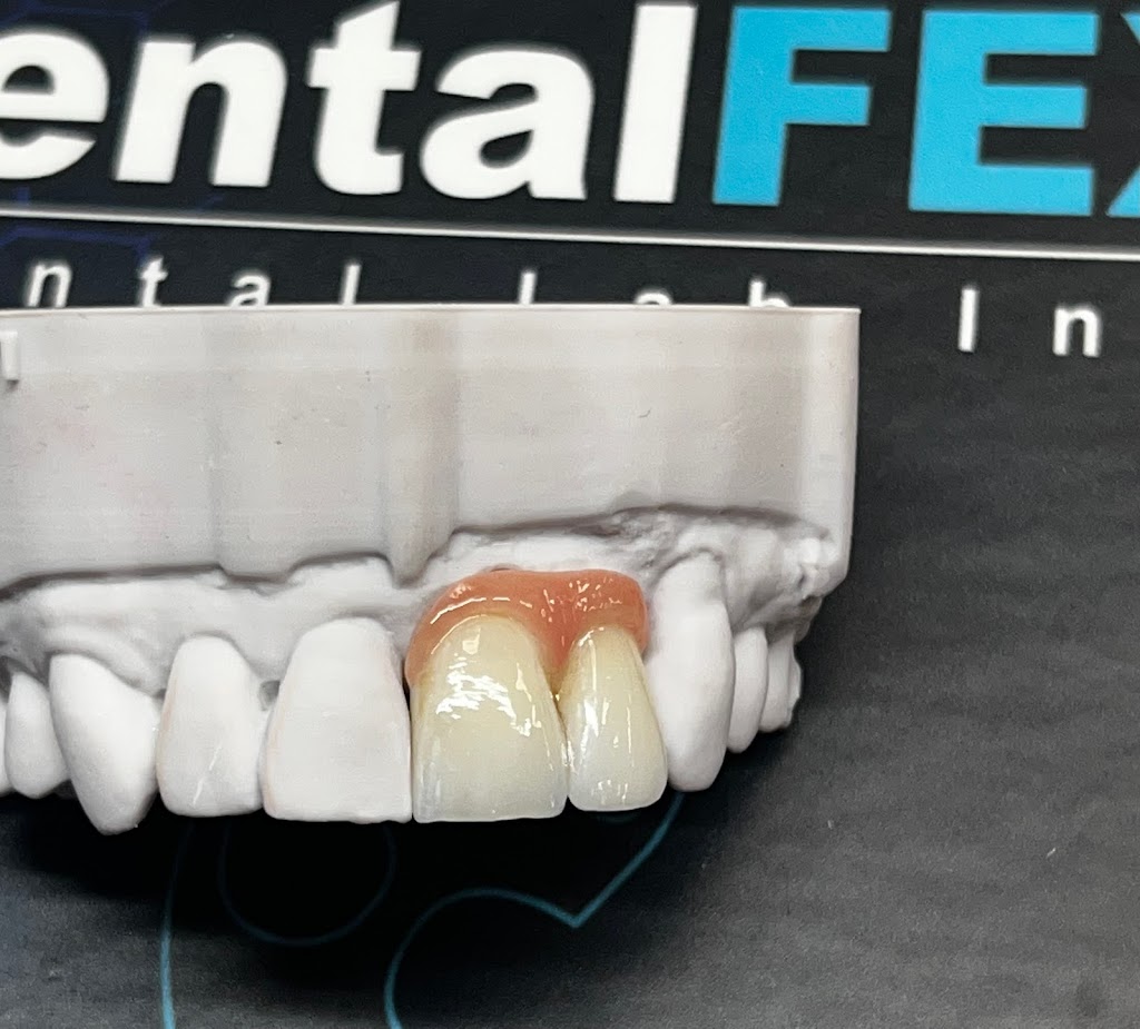 DentalFex Dental Lab | 665 Frontage Rd, Longmont, CO 80501, USA | Phone: (303) 651-2906