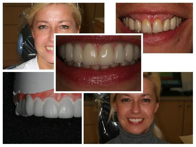 Gibberman Dental | 6303 Little River Turnpike #205, Alexandria, VA 22312, USA | Phone: (703) 823-6616