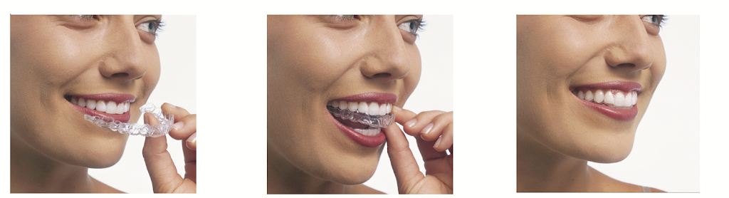 Fox Braces & Invisalign | 3501 NW 84th Ave, Sunrise, FL 33351 | Phone: (954) 741-2323