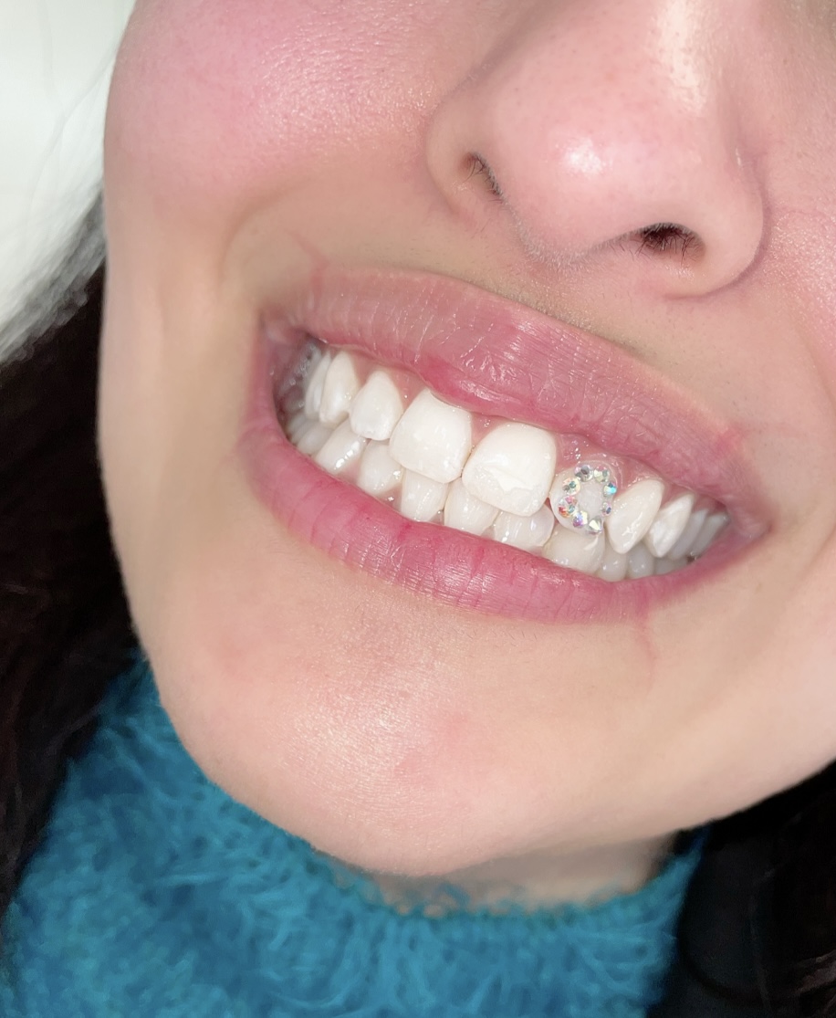 The Whitening Suite (Mobile Service only, We go to you) | 602 Mantoloking Rd Unit 2, Brick Township, NJ 08723, USA | Phone: (732) 859-7436