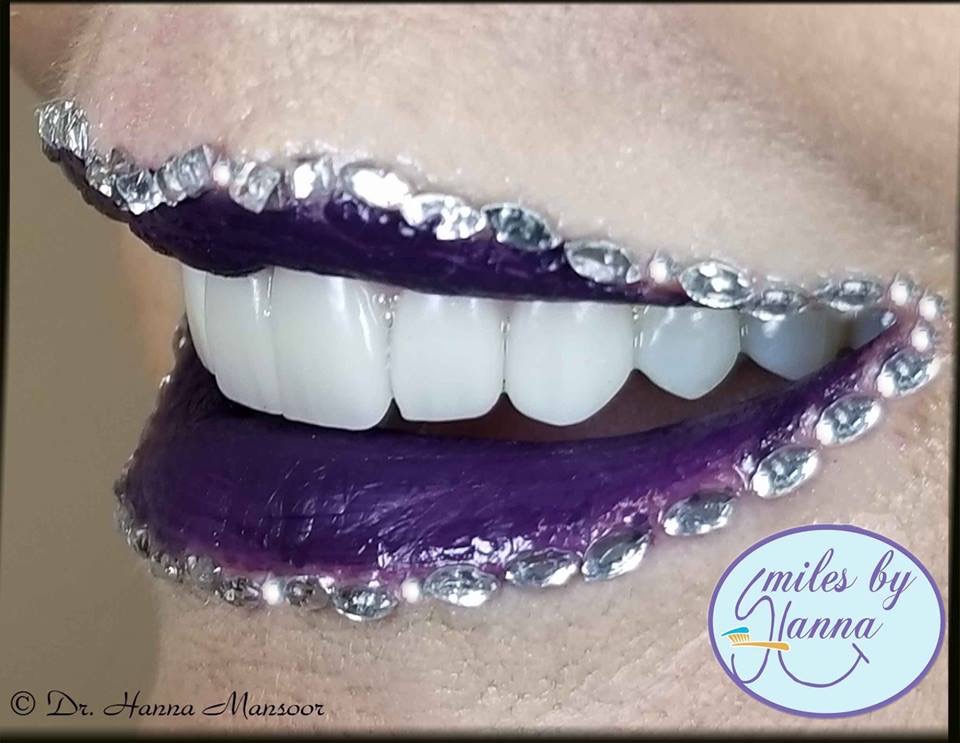 Smiles by Hanna | 1355 S Higley Rd STE 119, Gilbert, AZ 85296, USA | Phone: (480) 279-3700