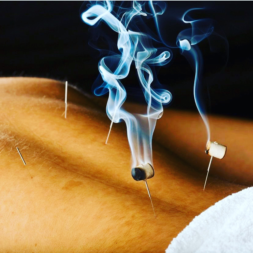 Monarch Acupuncture | 333 Glen Head Rd Suite 70, Glen Head, NY 11545, USA | Phone: (516) 801-0097