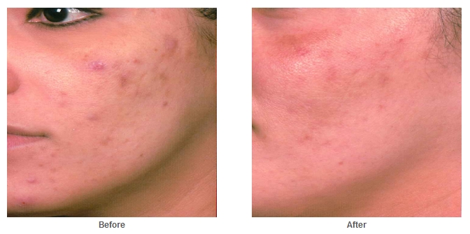 Angels Skin Care | 5919 Farralone Ave, Woodland Hills, CA 91367, USA | Phone: (818) 489-6613