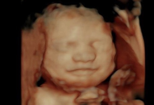 First Expressions Ultrasound | 1725 Gateway Cir, Grove City, OH 43123, USA | Phone: (614) 895-2229