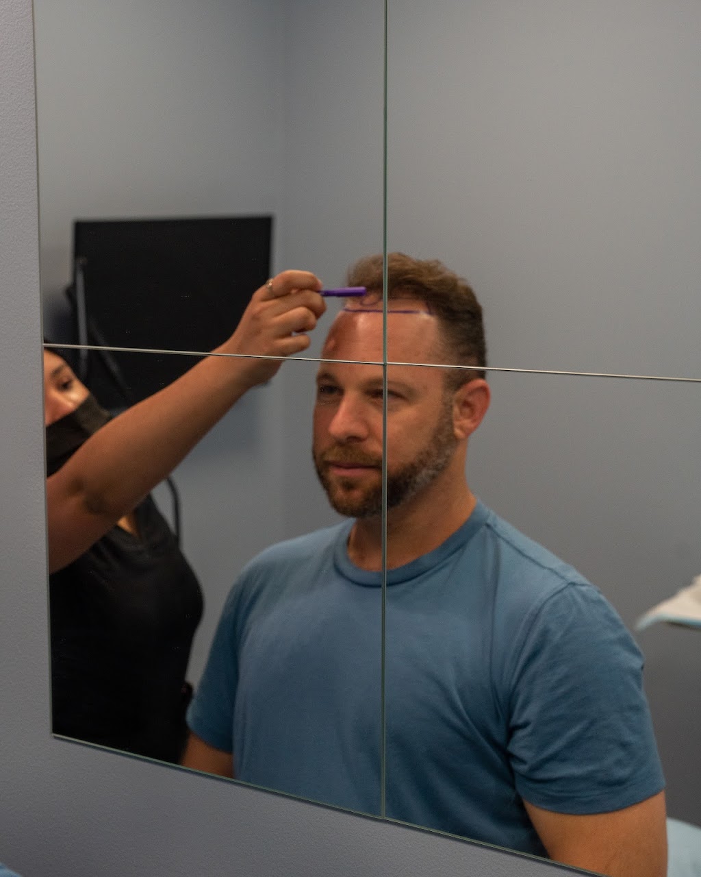 FUE Hair Transplant Solution New Jersey | 4057 Asbury Ave Suite 021, Tinton Falls, NJ 07753, USA | Phone: (848) 420-9970