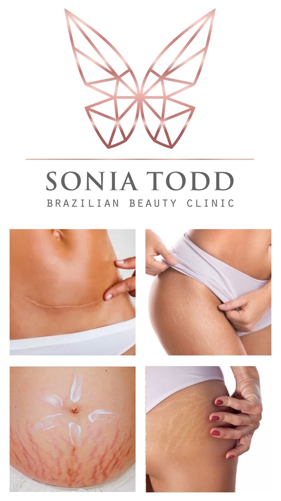 Sonia Todd Brazilian Beauty Clinic | 22011 Avenue San Luis, Los Angeles, CA 91364, USA | Phone: (818) 404-8226