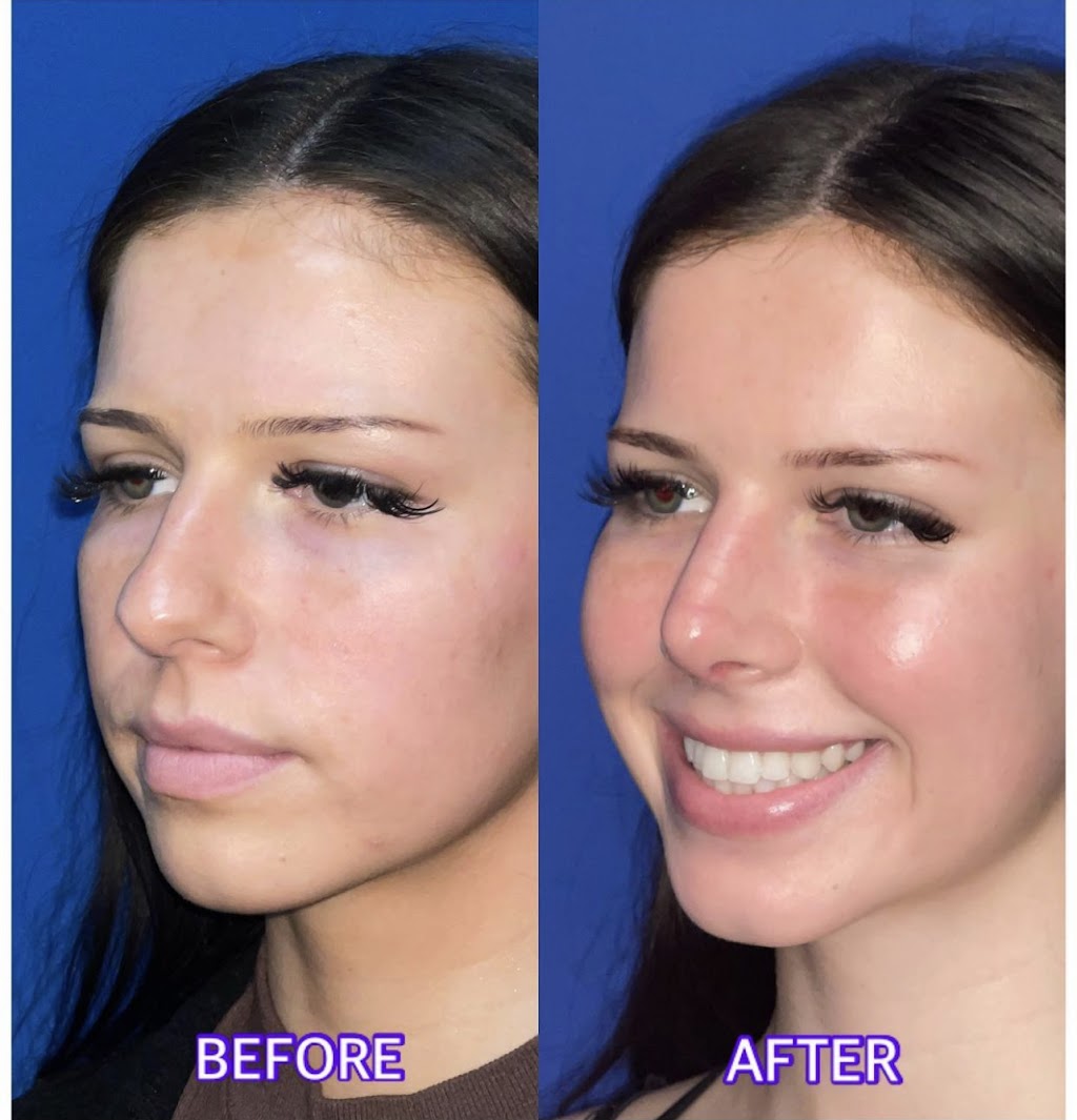 Modern Plastic Surgery: Dr. Shawn Moshrefi, M.D. | 24100 Calabasas Rd, Calabasas, CA 91302, USA | Phone: (818) 823-0655