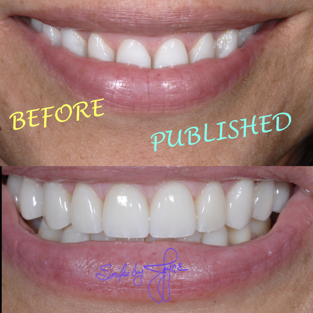 Bassett Joyce DDS | 3697, 14275 N 87th St # 215, Scottsdale, AZ 85260, USA | Phone: (480) 367-8889