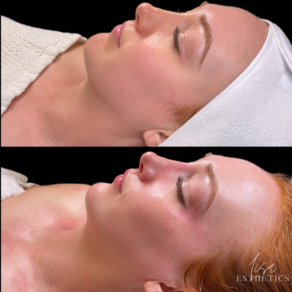 Lisa Esthetics | 5809 Bardstown Rd, Louisville, KY 40291, USA | Phone: (859) 913-9158