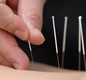 Acumedi Health Center Acupuncture Inc. | 3400 W Olympic Blvd Ste 207, Los Angeles, CA 90019, USA | Phone: (213) 365-2277