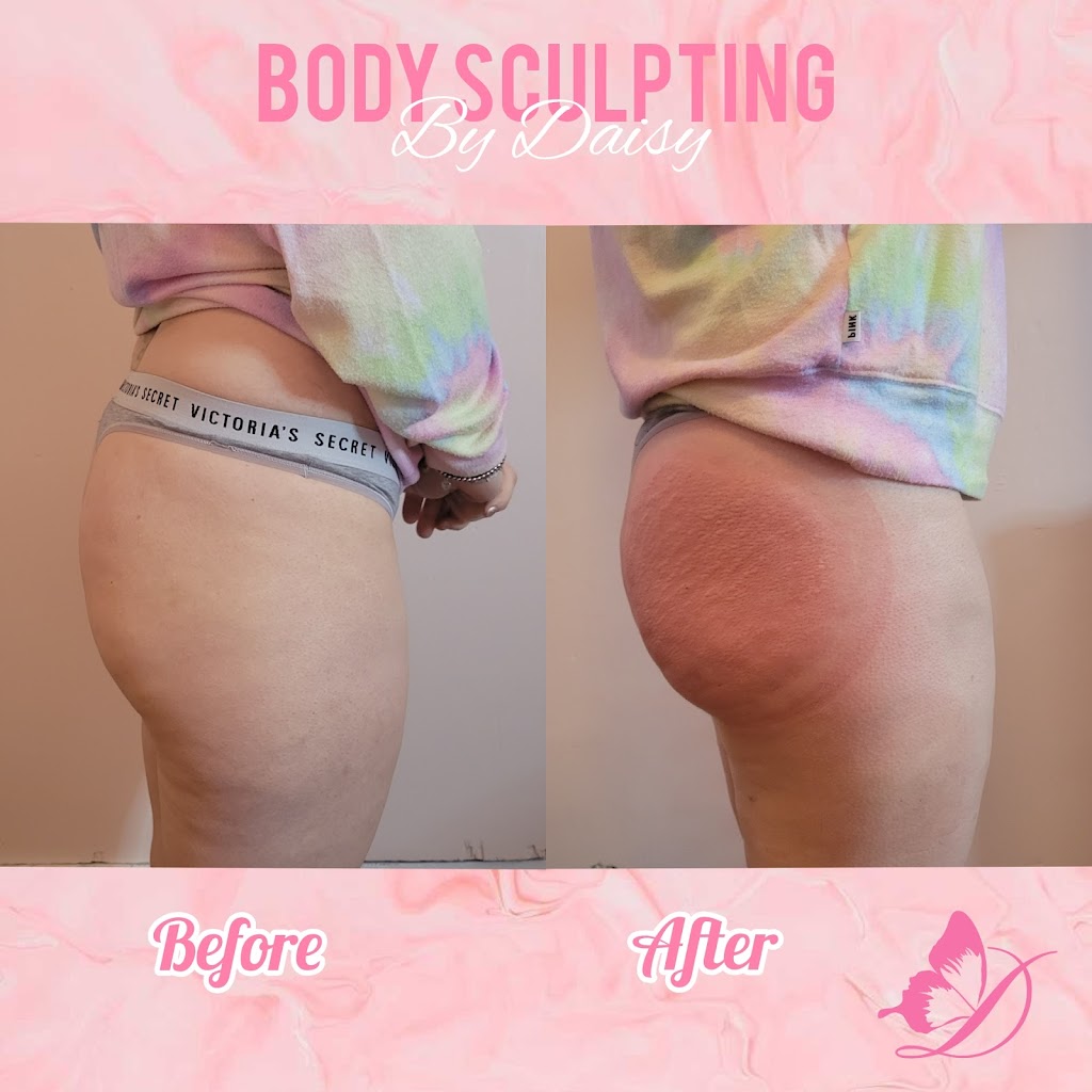 Body Sculpting By Daisy | 8652 Laurel Canyon Blvd, Sun Valley, CA 91352, USA | Phone: (818) 749-5549