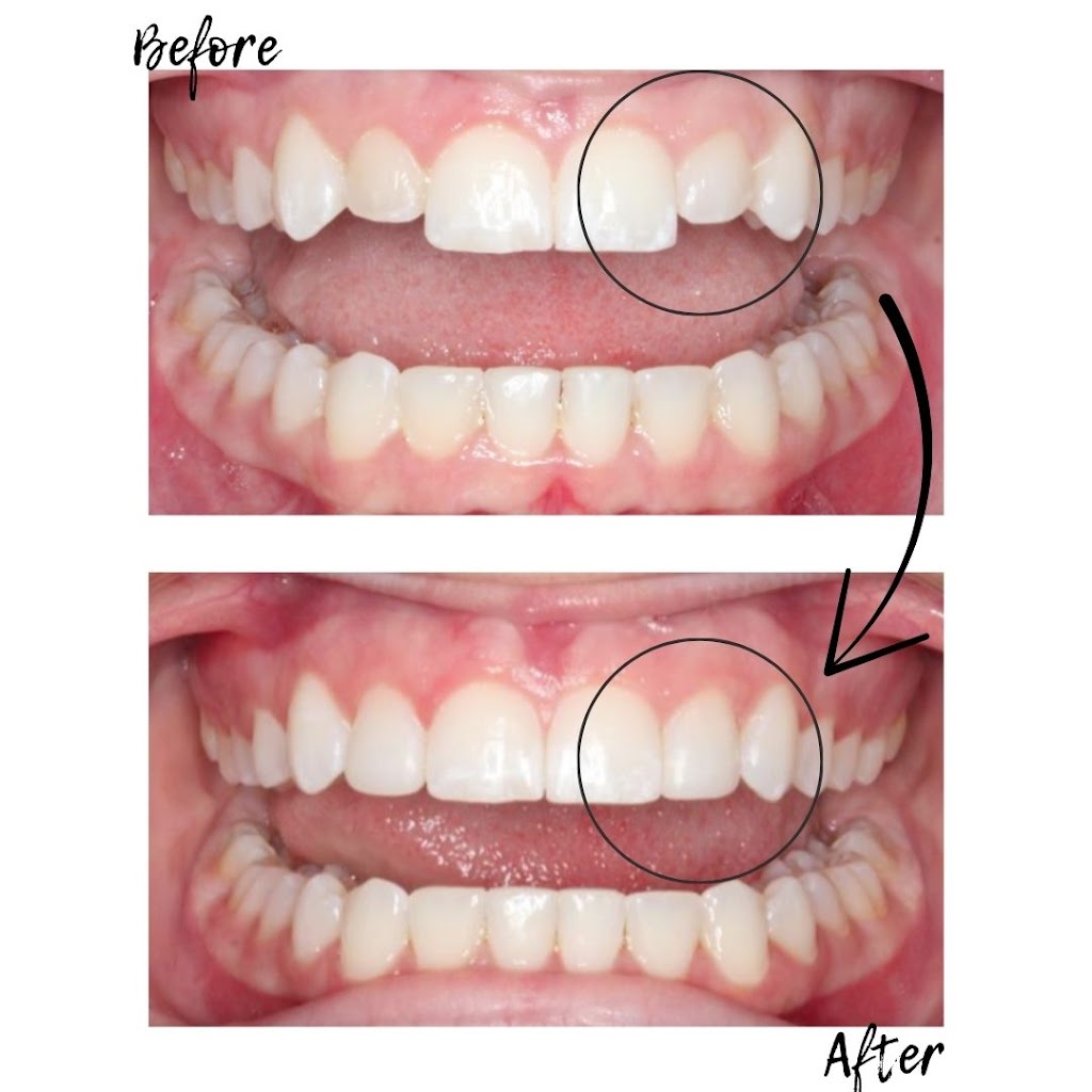 Carroll & Sutton Orthodontics | 8208 Tourist Center Dr, Bradenton, FL 34201, USA | Phone: (941) 366-1612