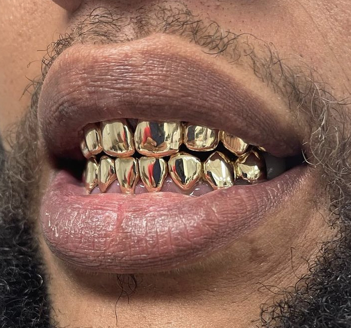 Gold Teeth Master | 3503 E Hillsborough Ave B, Tampa, FL 33610, USA | Phone: (813) 997-9247