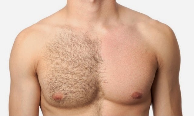 Roslyn Hair Removal & Electrolysis | 1137 Willis Ave, Albertson, NY 11507, USA | Phone: (516) 669-2892