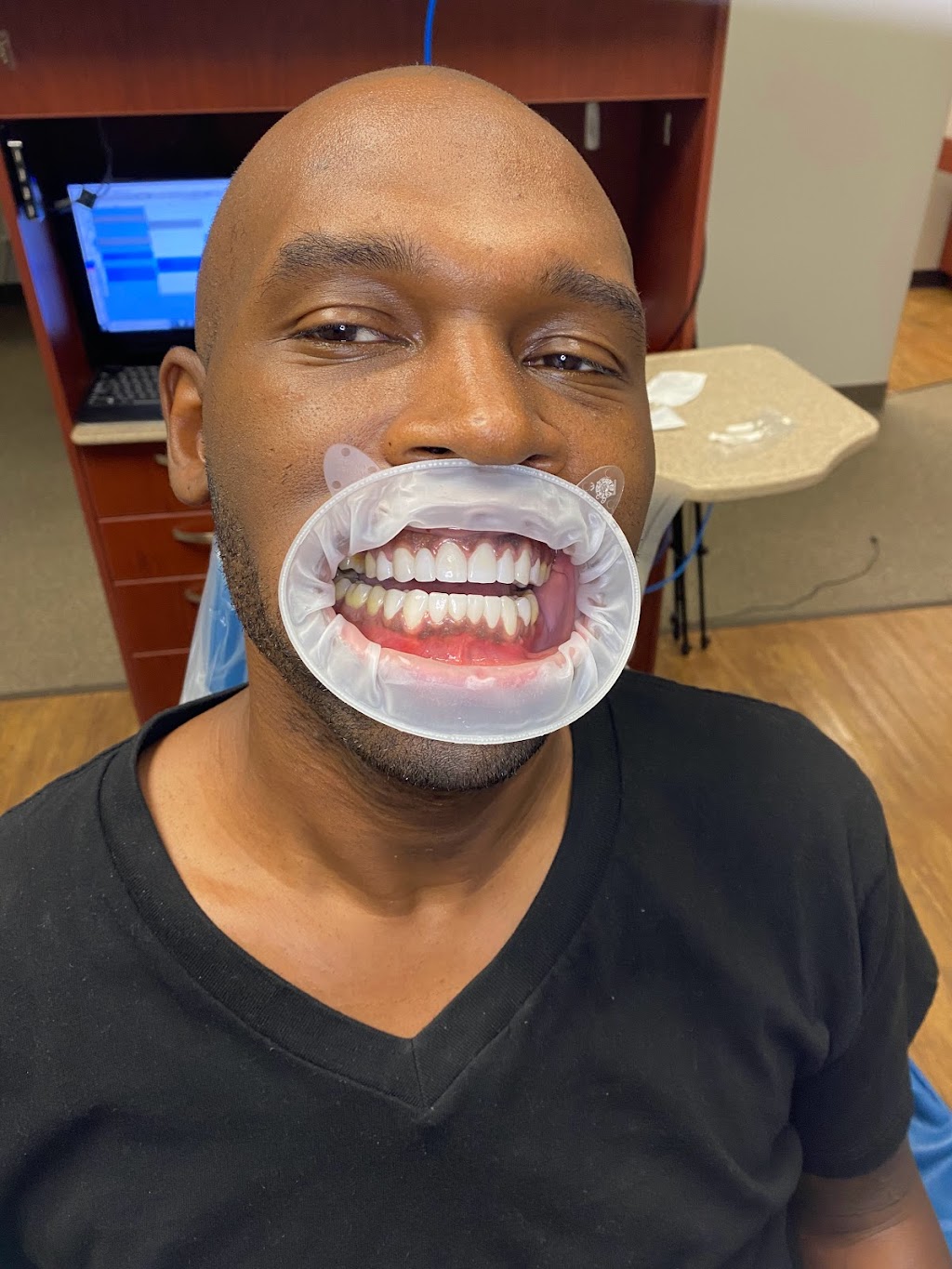 Turner Family Dental | 3450 Bainbridge Dr #570, Dallas, TX 75237, USA | Phone: (972) 709-7414