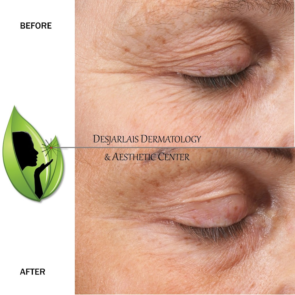 Desjarlais Dermatology & Aesthetic Center | 2000 Curtis Rd, Adrian, MI 49221, USA | Phone: (517) 264-5603