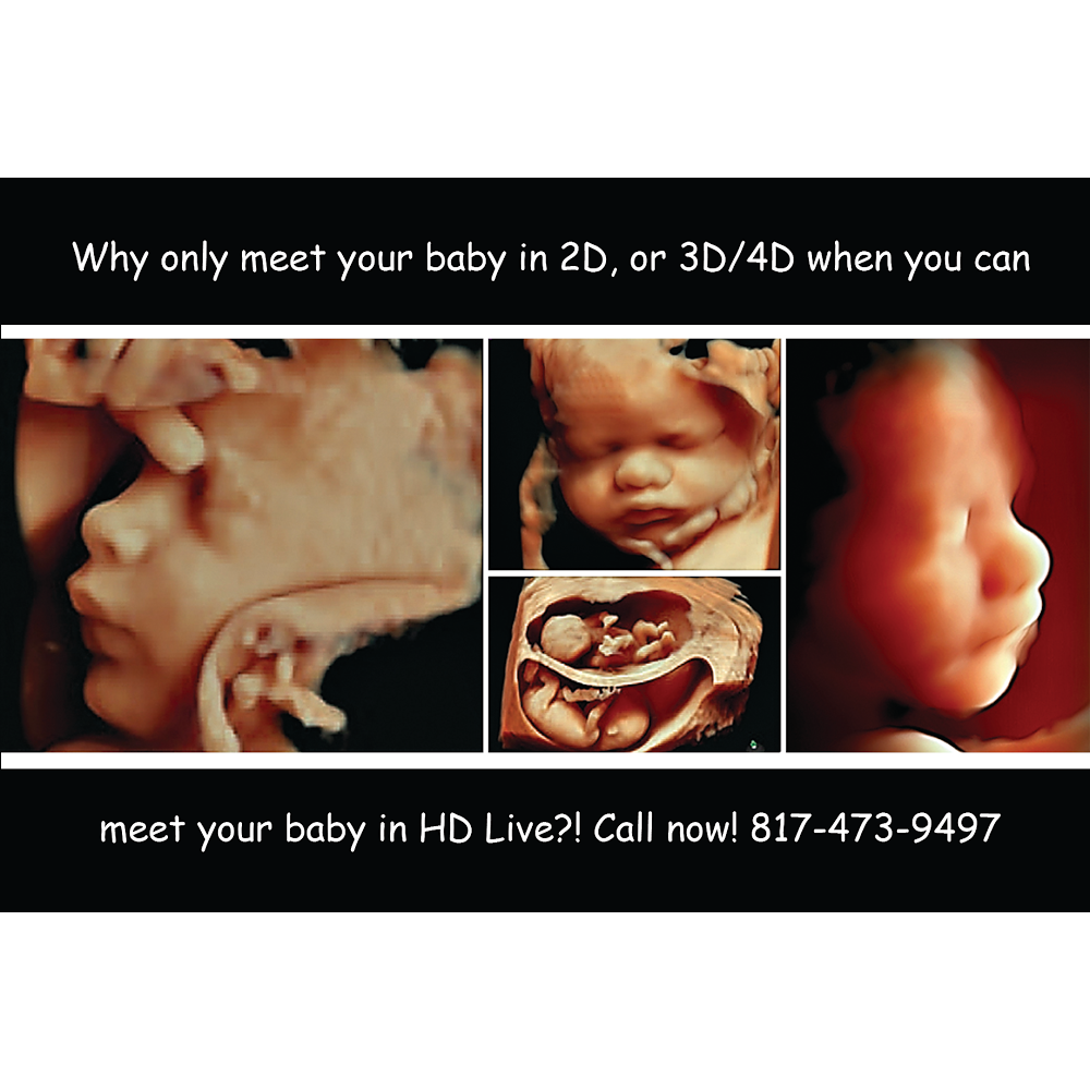 Baby View HD | 208 E Broad St, Mansfield, TX 76063, USA | Phone: (817) 368-1166