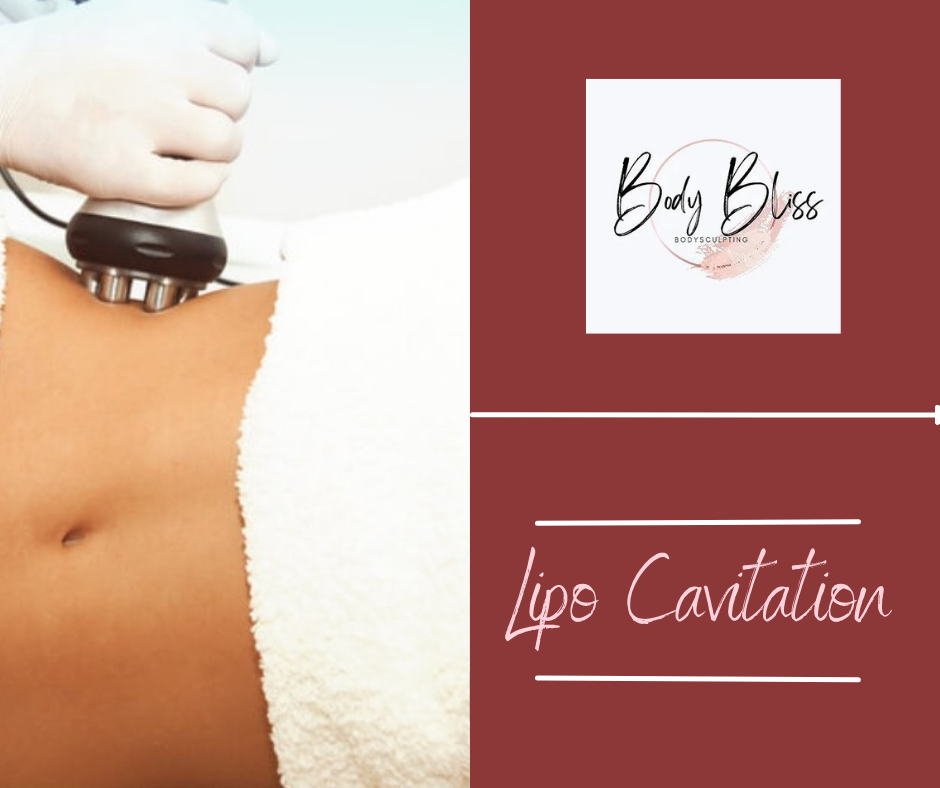 Body Bliss Bodysculpting | 4120 Kingsley St #18, Montclair, CA 91763, USA | Phone: (909) 955-2054