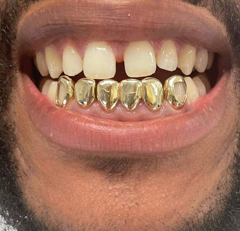 Gold Grillz & Jewelry, Gold2Ink LLC | 1503 NW 47th Ave, Lauderhill, FL 33313, USA | Phone: (979) 291-8055